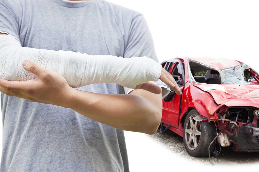 Common Bone Fractures Caused by Phoenix Car Accidents