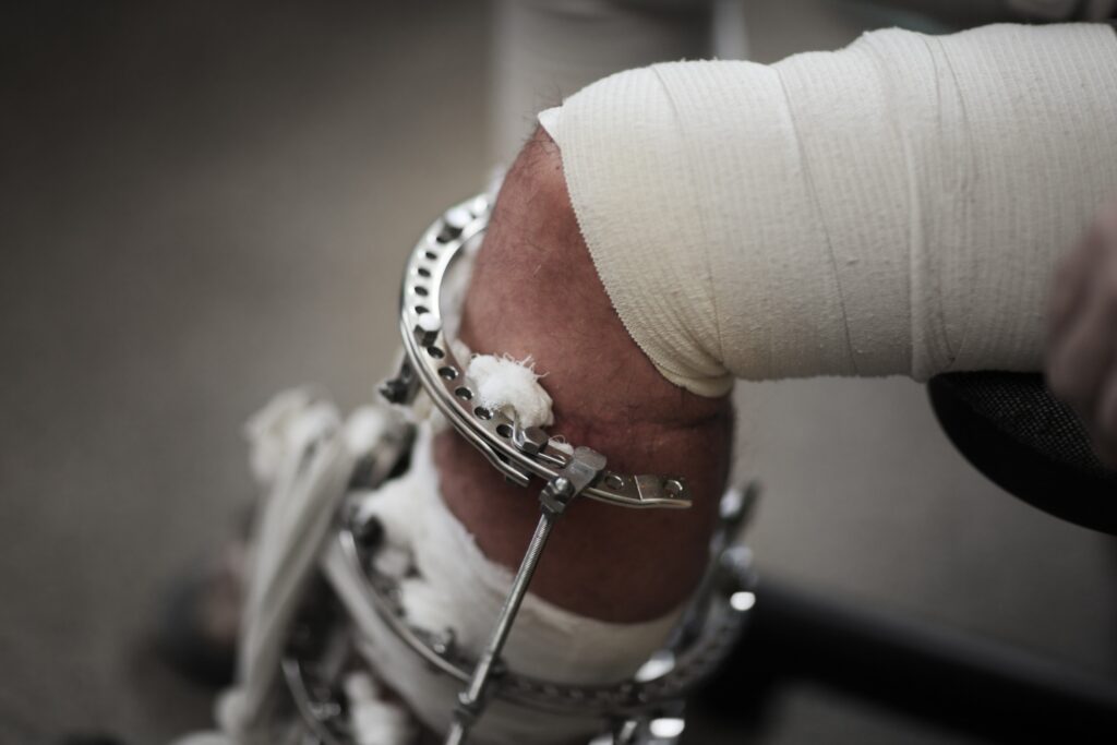 Indian Springs personal injury