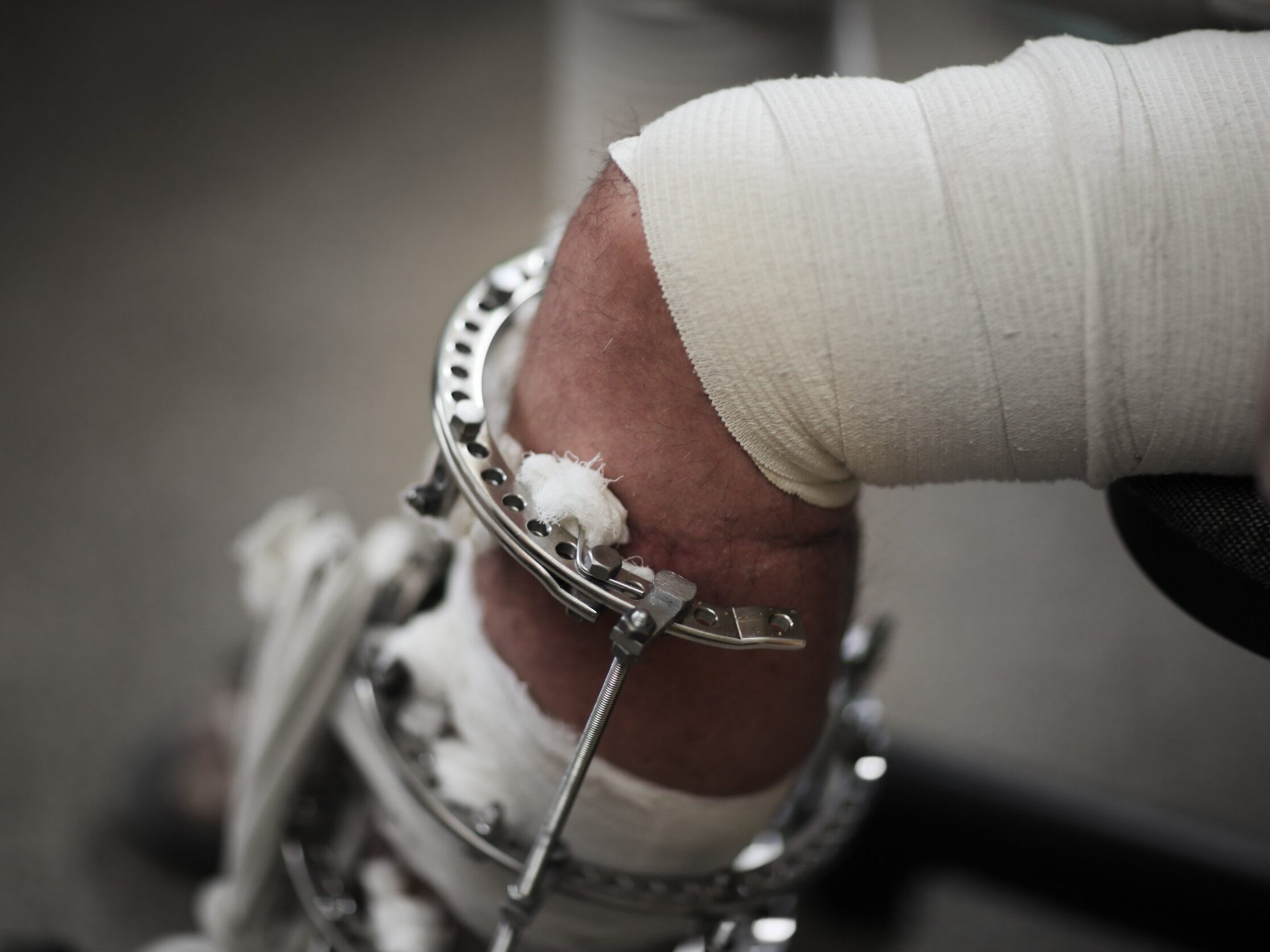 Abogados de lesiones personales en Indian Springs