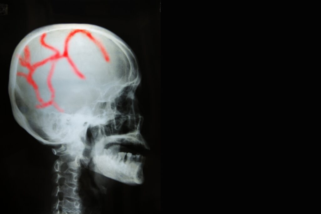 Abogado de accidentes de motocicleta en Yuma