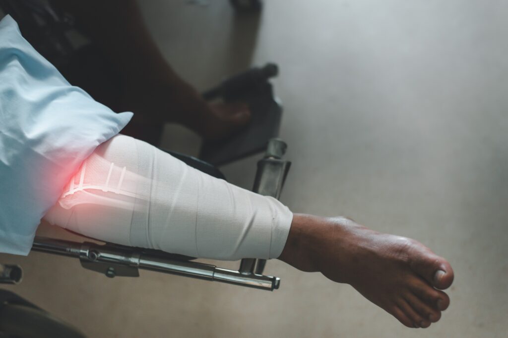 Abogados de accidentes de motocicleta en Bullhead City