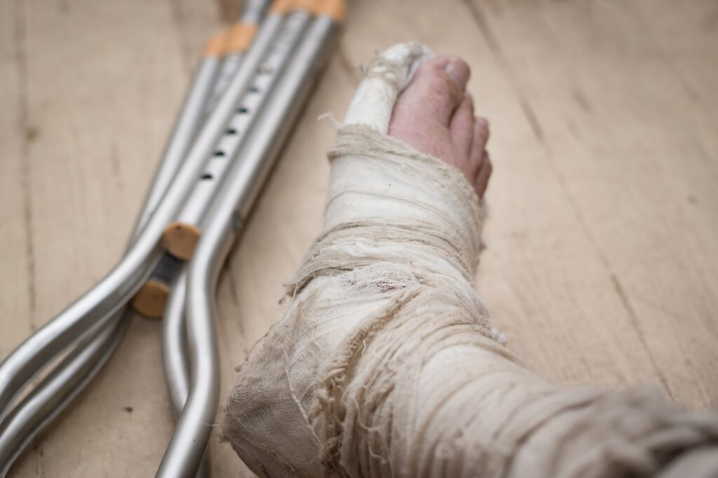 Summerlin Broken Bone Lawyers