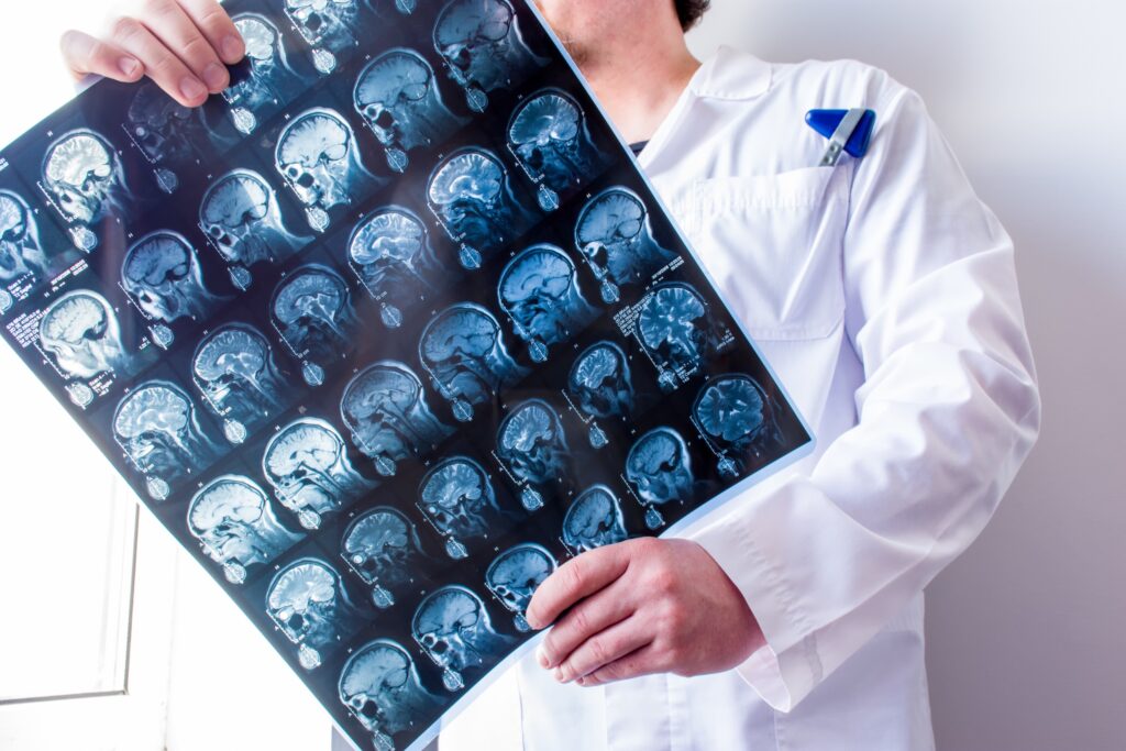 Abogados de lesiones cerebrales en Elgin