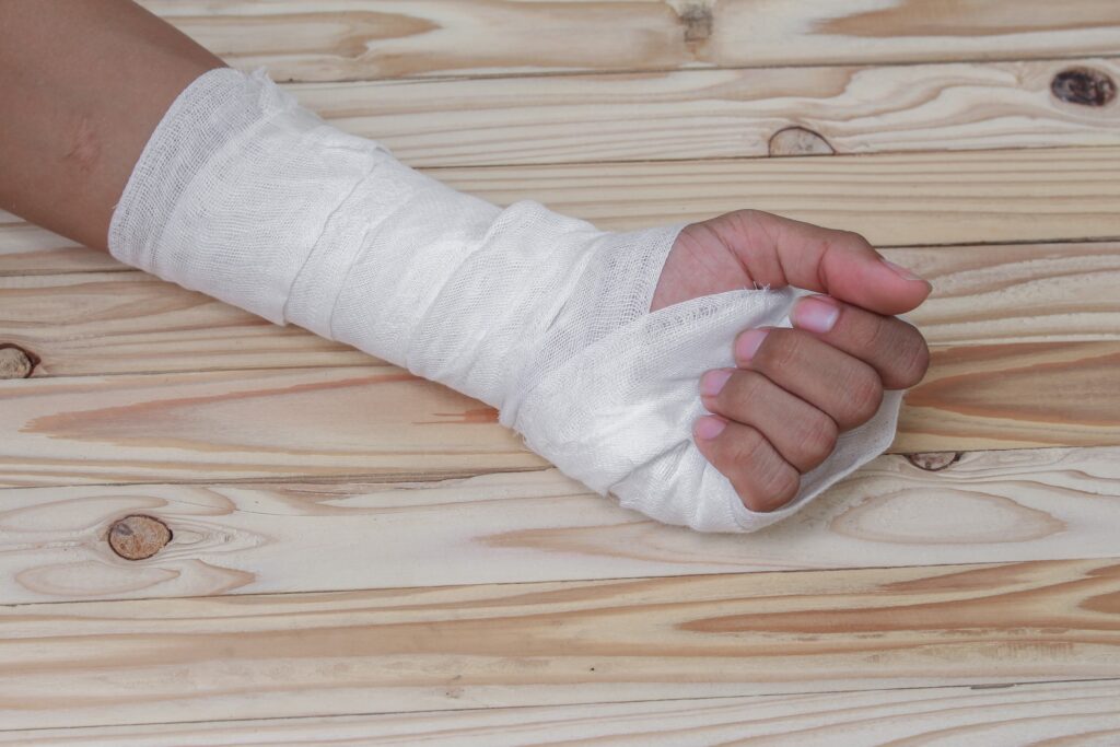 Gilbert Dog Bite Injury Lawyer