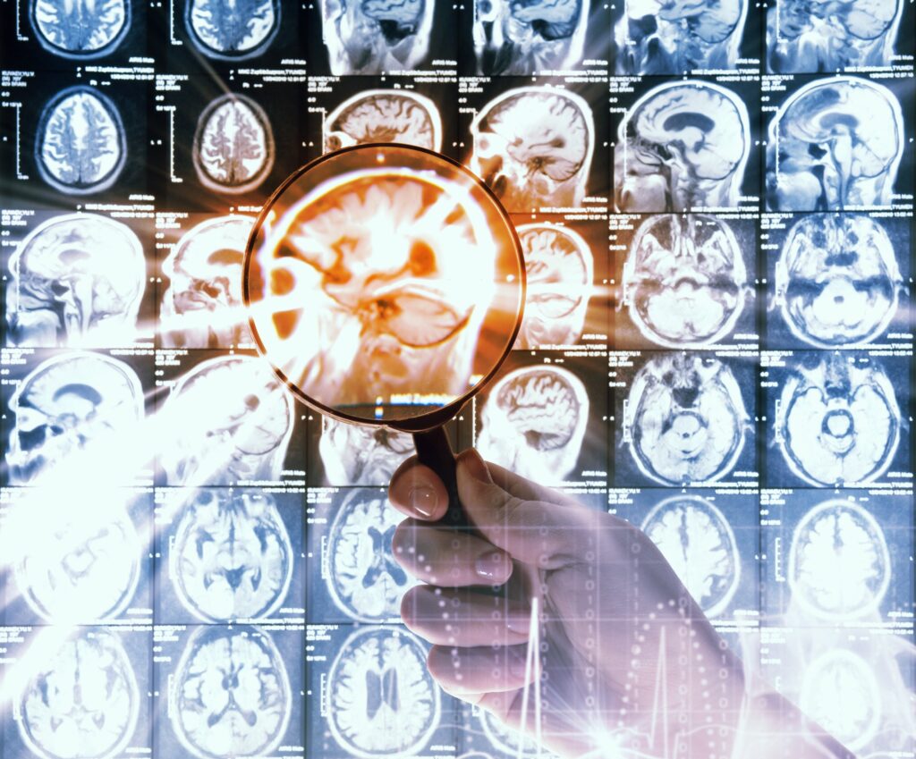 Abogados de lesiones cerebrales en Green Valley, Nevada