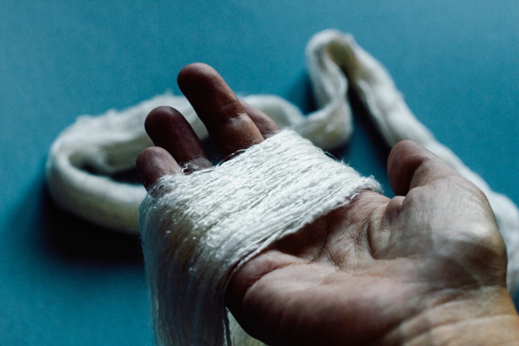 Santa Fe Burn Injury Lawyers