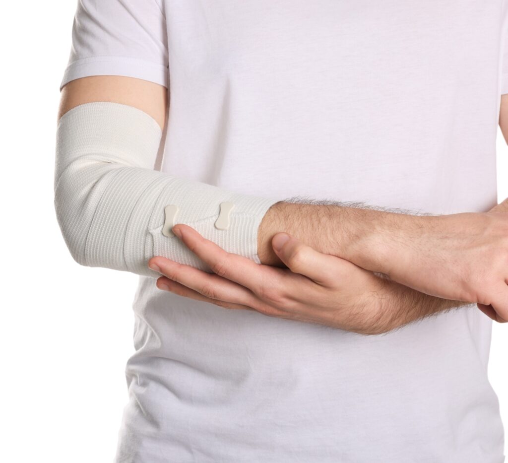 Fallon Burn Injuries Lawyer
