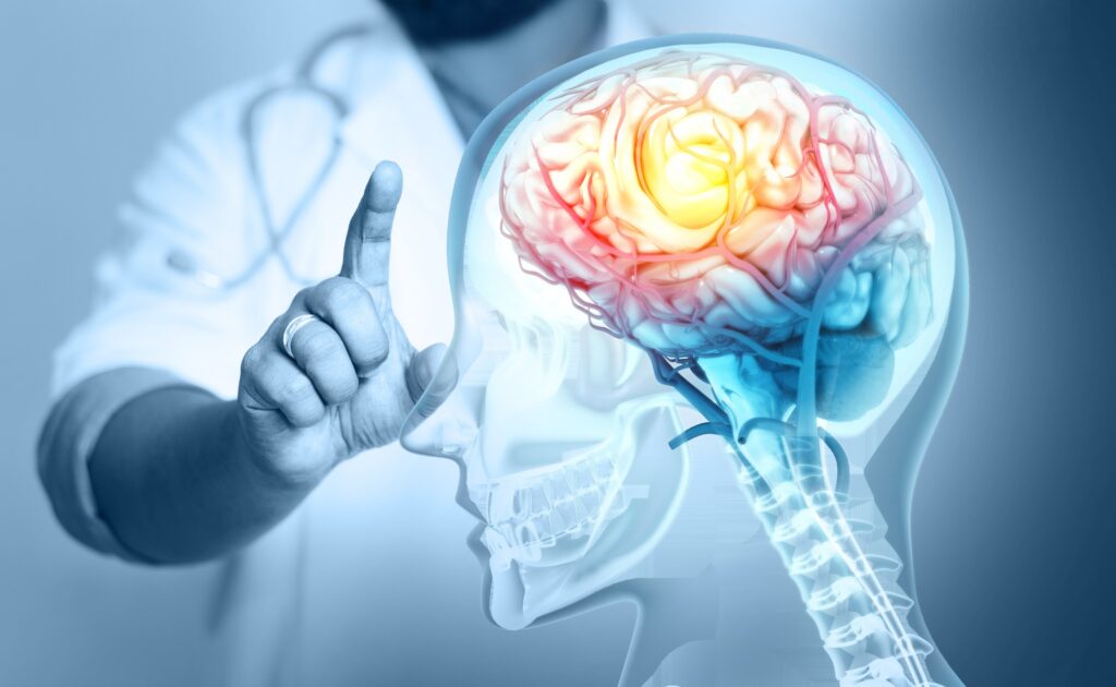 Abogados de lesiones cerebrales en Albuquerque
