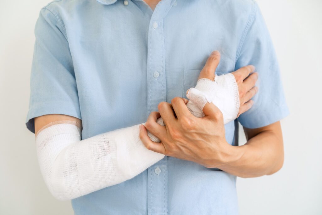 Roswell Burn Injuries Lawyer