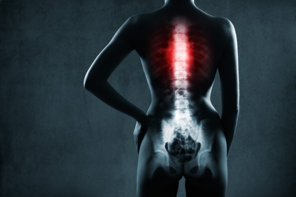 Sun Valley Spinal Injury Lawyer