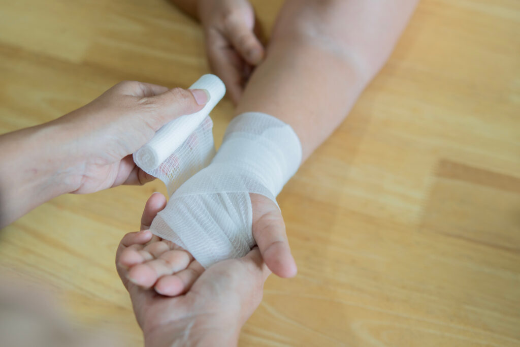 Battle Mountain Burn Injuries Lawyer