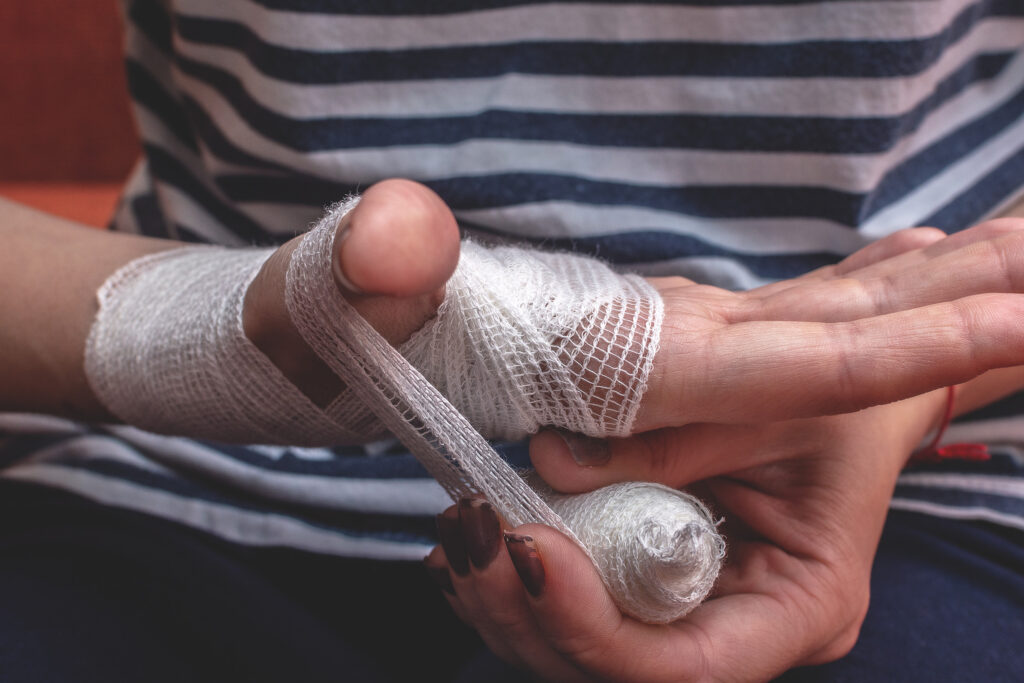 Hawthorne Burn Injuries Lawyer