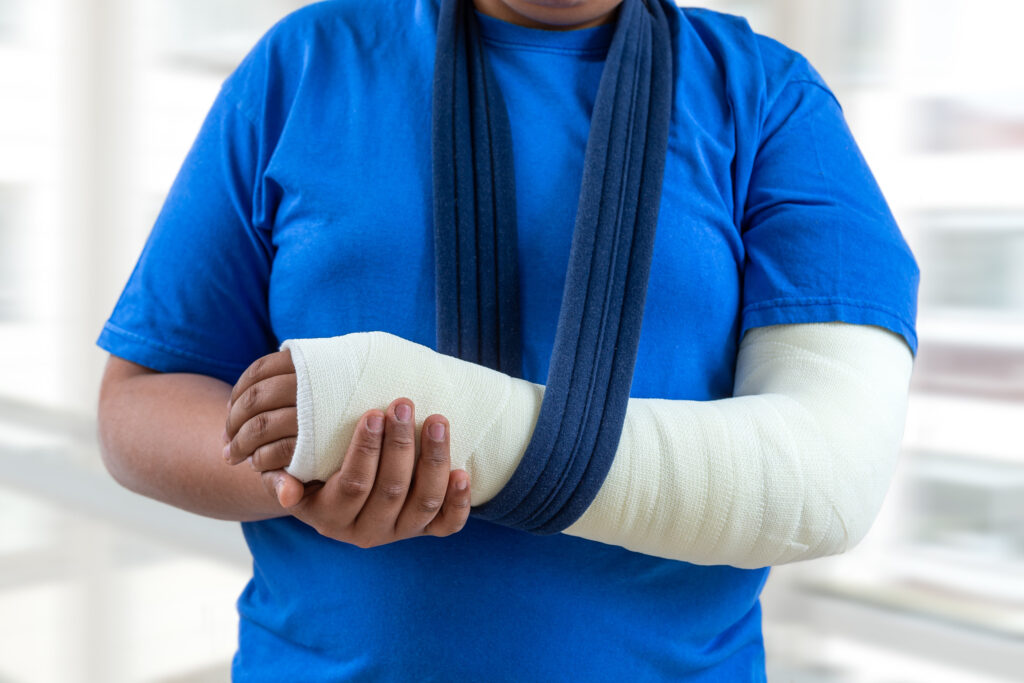Clovis Bone Fractures Lawyer