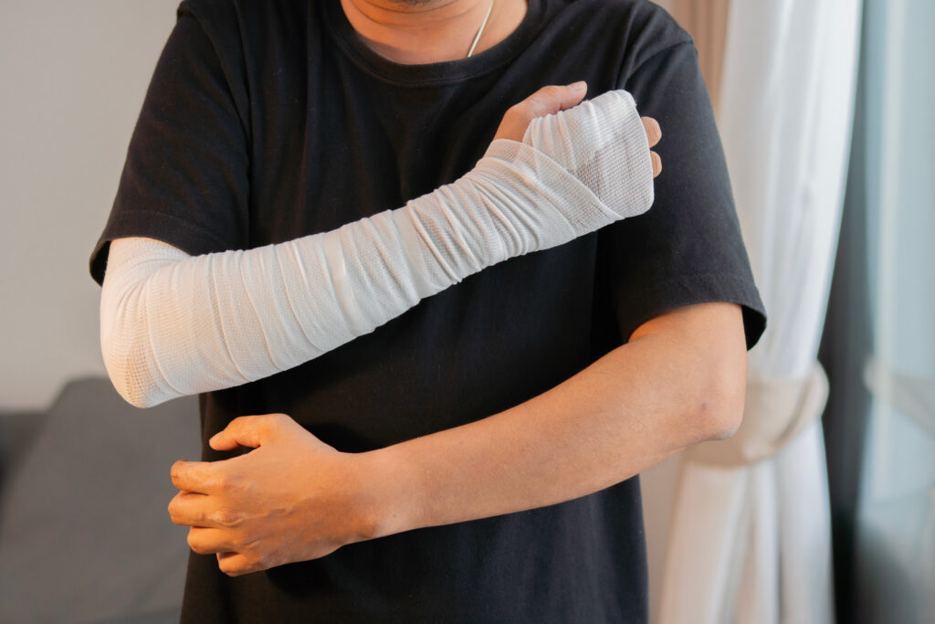 Clovis Burn Injuries Lawyer