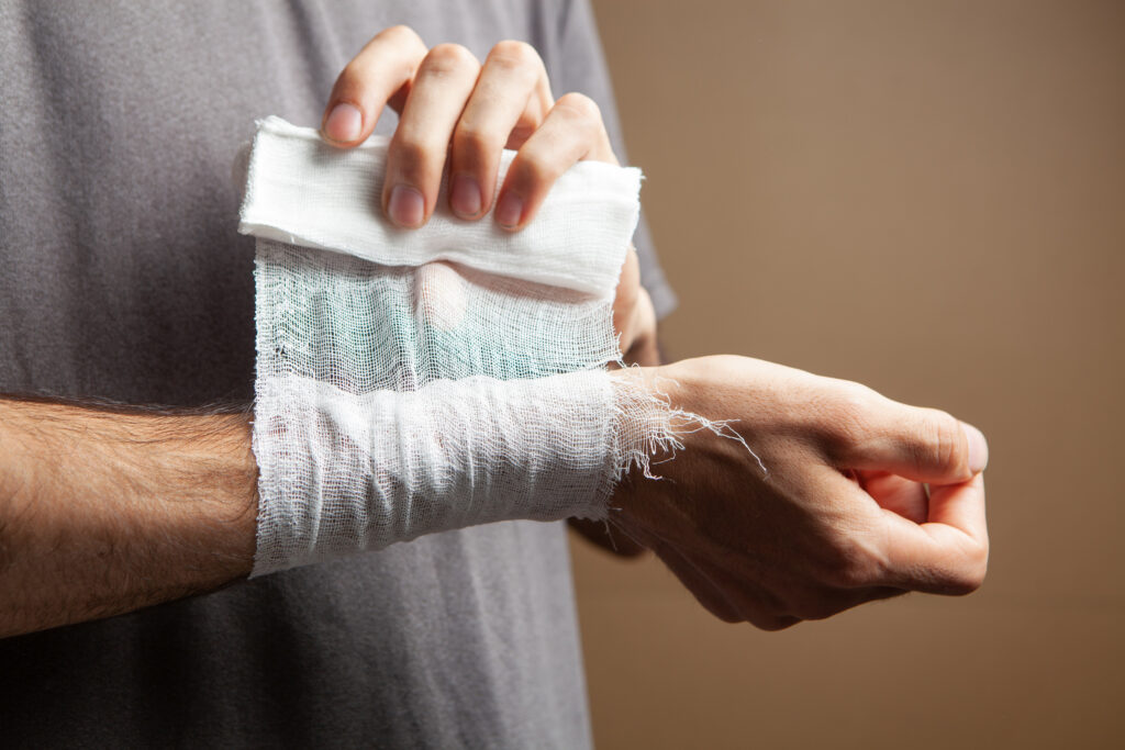 Kingsbury Burn Injuries Lawyer