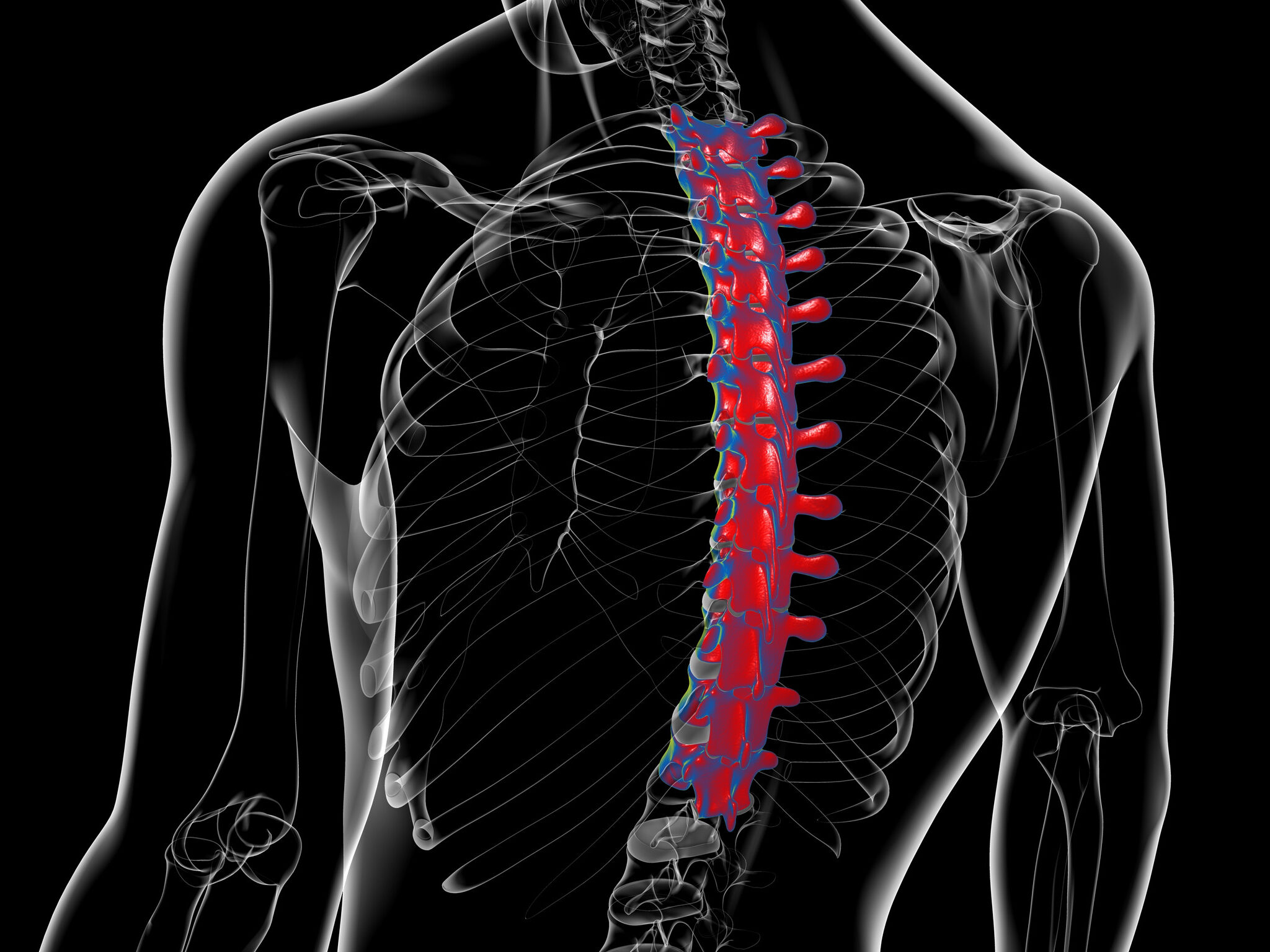 Carlin Spinal Injury Lawyer