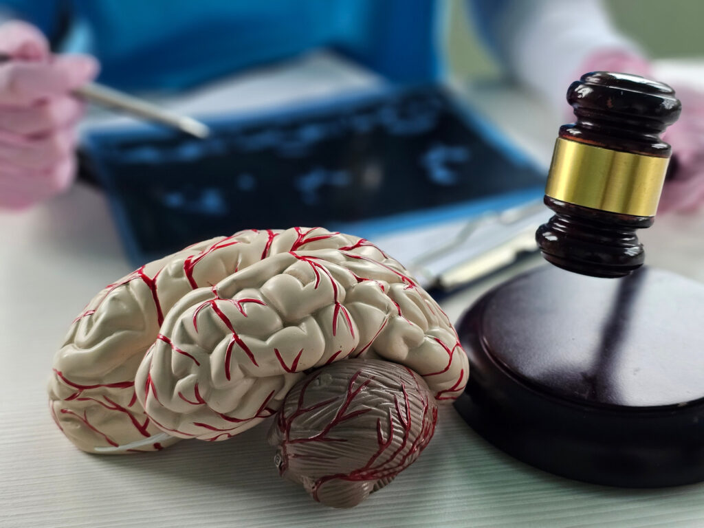 Moapa Brain Injury Lawyer