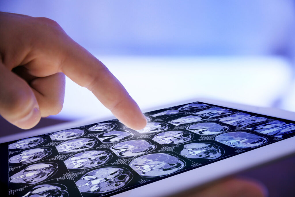 Maywood Brain Injury Lawyer