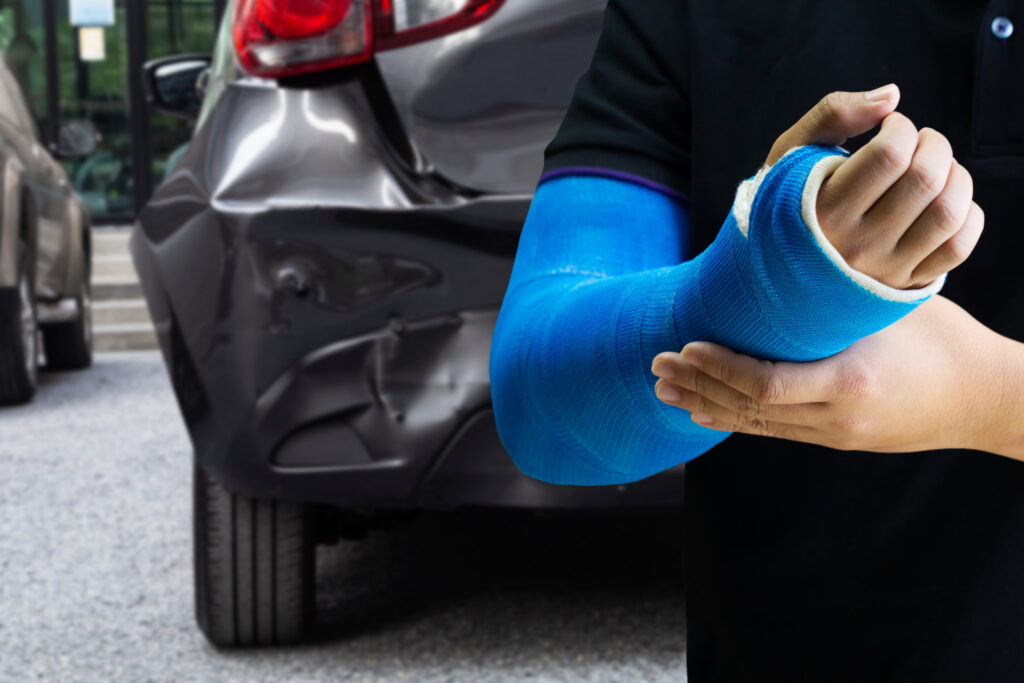 Costa Mesa Personal Injury Lawyer
