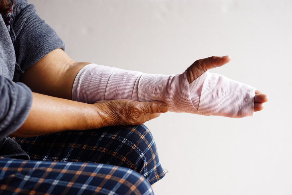 El Paso Burn Injuries Lawyer
