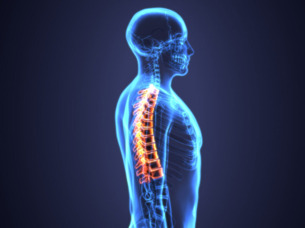 Abogados de lesiones de la columna vertebral en Seattle