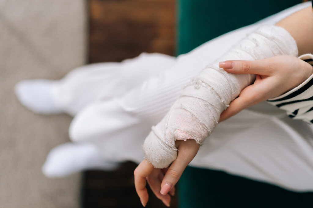 Huntington Beach Burn Injuries Lawyer