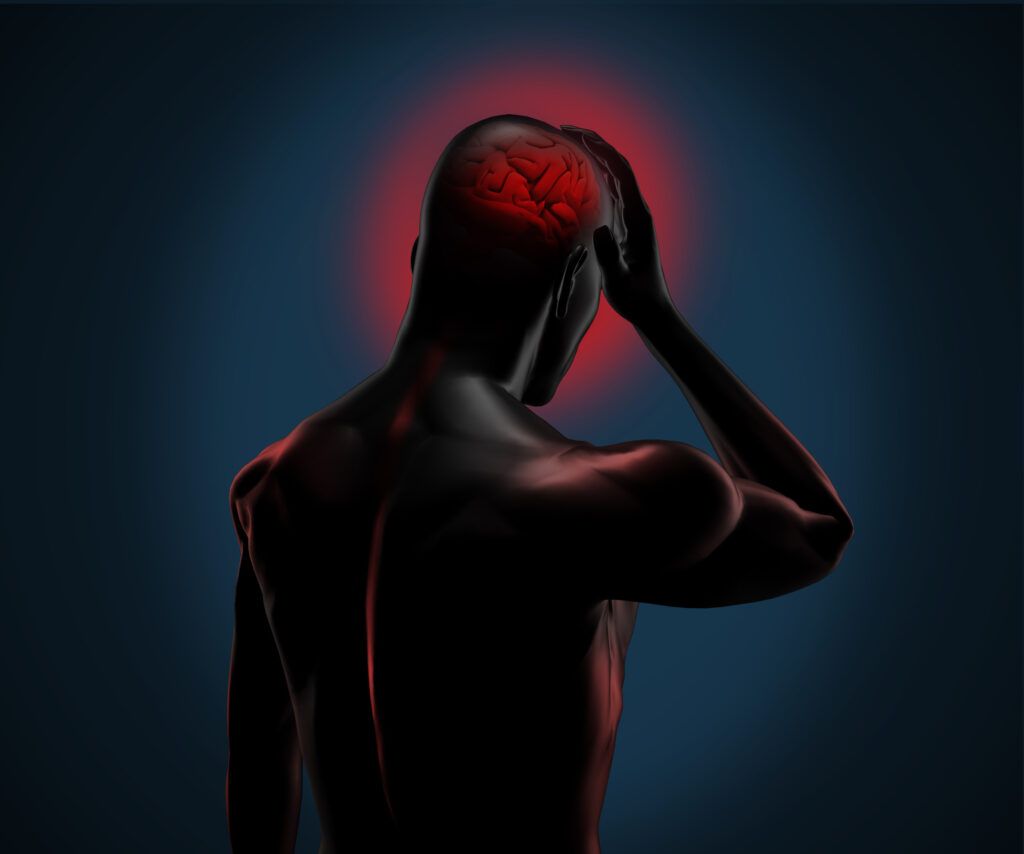 Irvine Brain Injury Lawyer