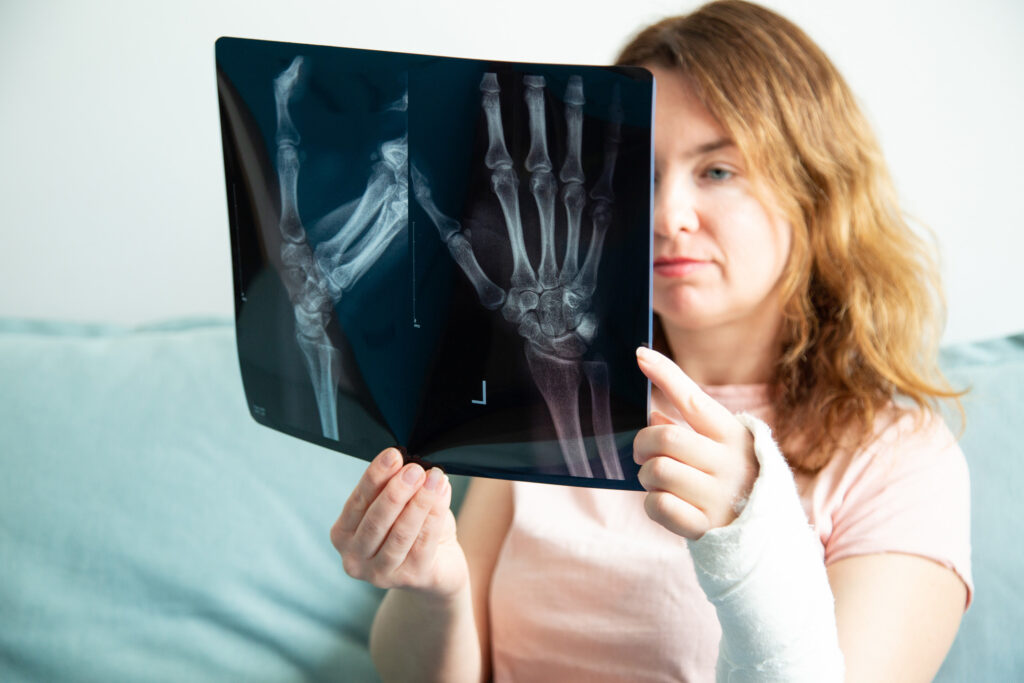 Maywood Bone Fractures Lawyer