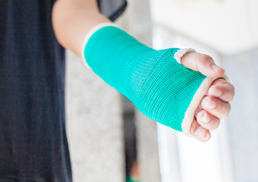 Mission Viejo Bone Fractures Lawyer