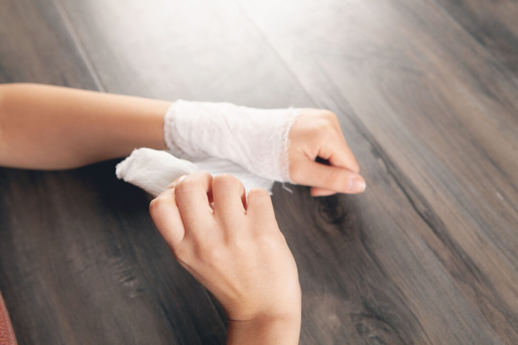 Santa Ana Burn Injuries Lawyer