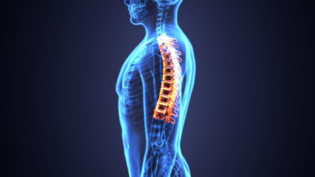 Seattle Spinal Injury Attorney