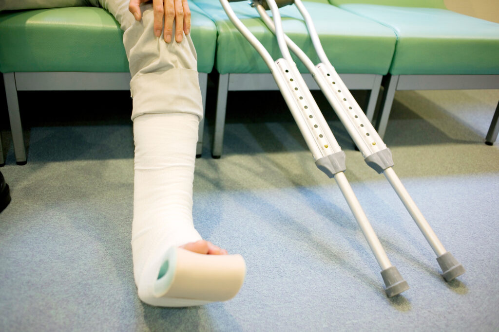 Anaheim Bone Fractures Lawyer
