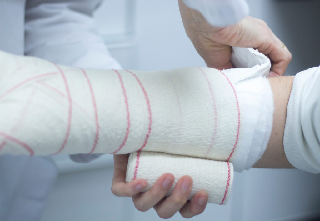 Garden Grove Bone Fractures Lawyer