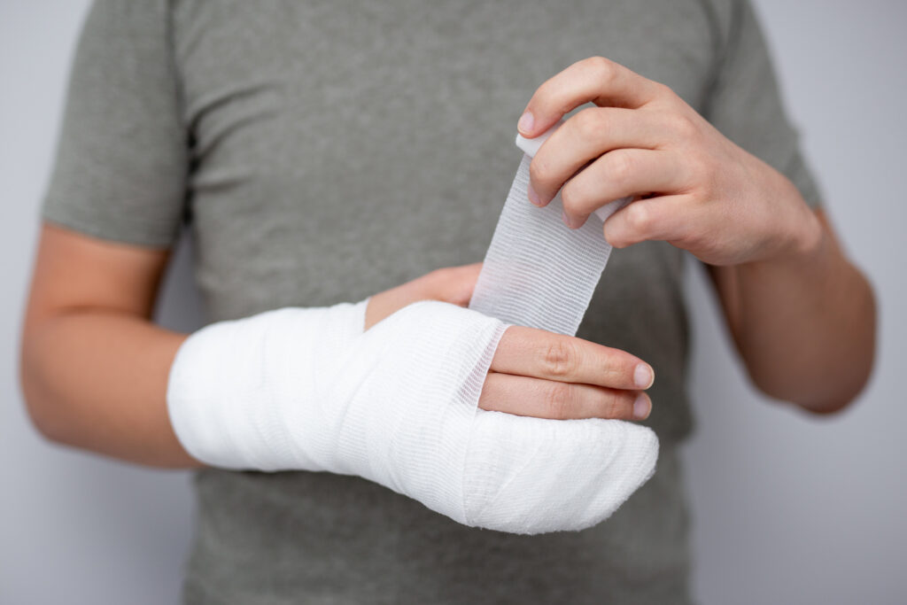 Lake Forest Burn Lawyer