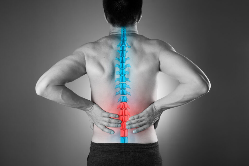 Laguna Beach Spinal Injury Lawyer