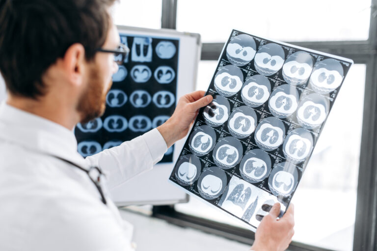Newport Beach Brain Injury Lawyer
