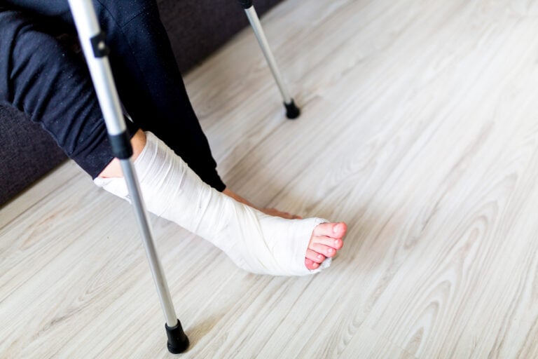 Peoria, Arizona, Bone Fractures Lawyer