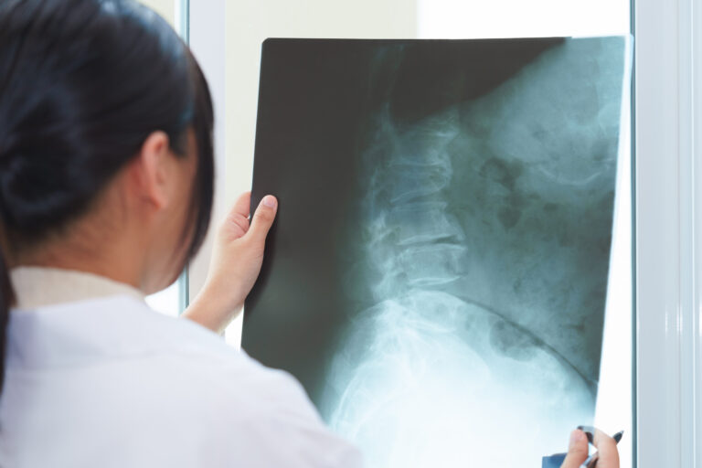 Scottsdale Spinal Injury Lawyer
