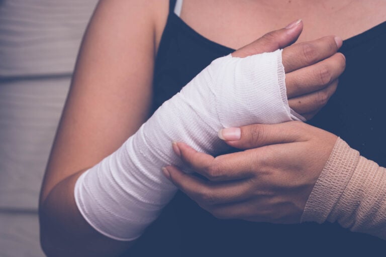 Goodyear Burn Injuries Lawyer