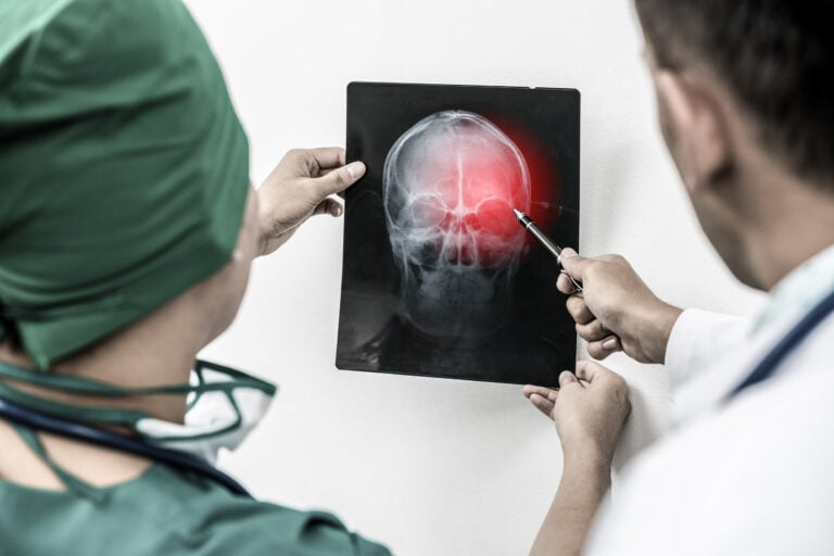 Santa Monica Brain Injury Lawyer
