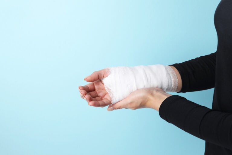 Santa Monica Burn Injuries Lawyer