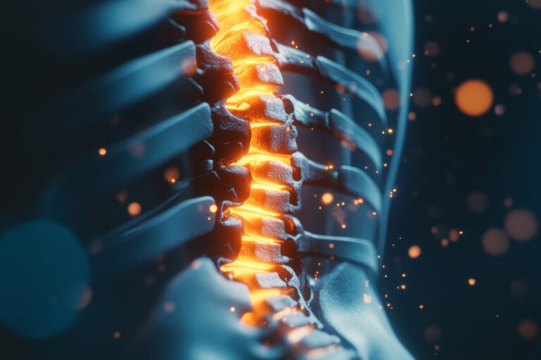 Pasadena Spinal Injury Lawyer