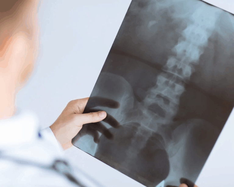 Abogados de lesiones de la columna vertebral en Peoria, Arizona