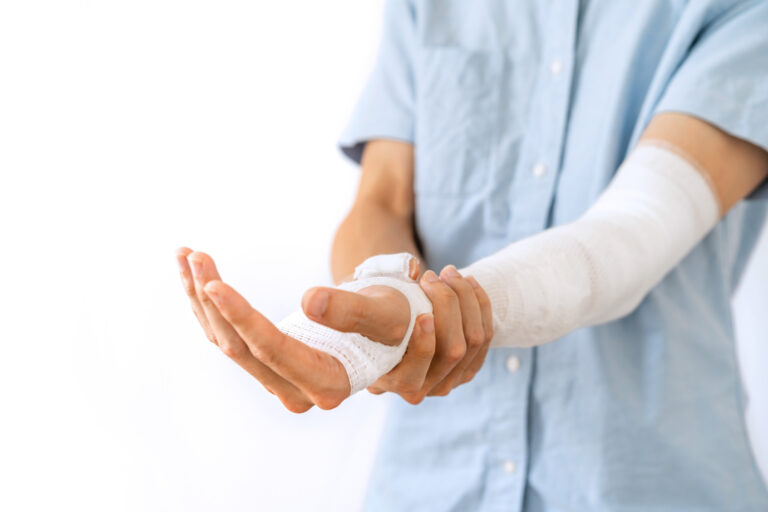 San Bernardino Burn Injuries Lawyer