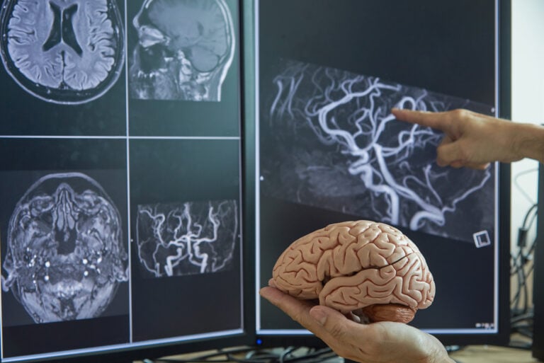 Kingman Brain Injury Lawyer