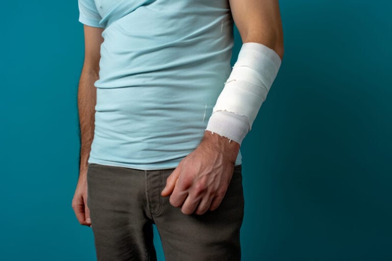 Kingman, Arizona Burn Injuries Lawyer